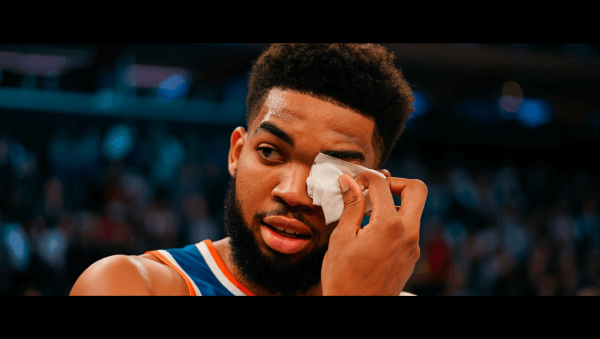 Karl Anthony Towns Suffers Cut Over Right Eye After Collision With karl-anthony-towns-suffers-cut-over-right-eye-after-collision-with